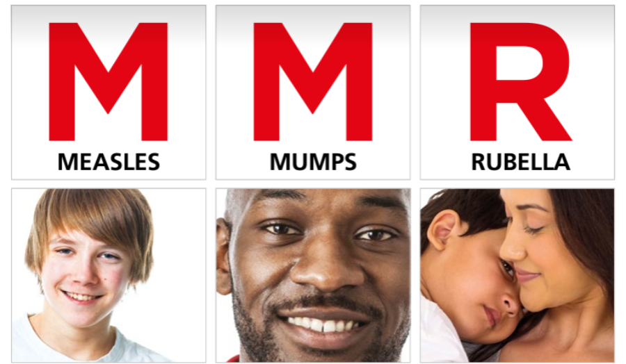 Measles, mumps and rubella (MMR)